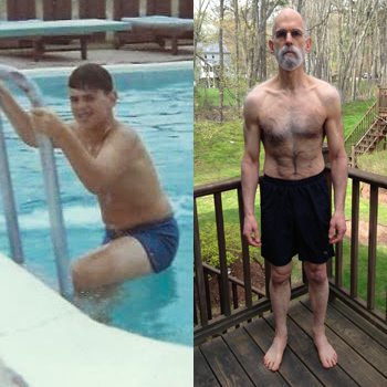 before & after picture of Stephen Stern 