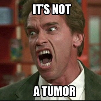 its not a tumor