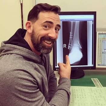 an injury may cause stiff ankles